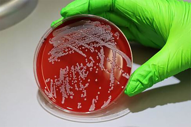 El superenemigo de la salud